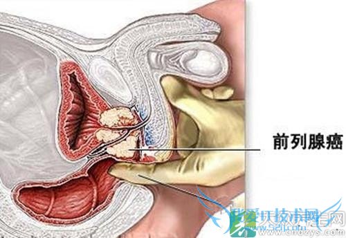 6��Ѫ�ܾ����������������Ѫ��(5)