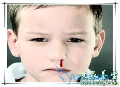 2�걦����������Ѫ��ô�죿(1)