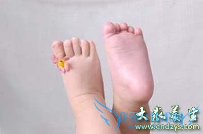 Ӥ����ƽ�����Ԥ�����ʵ����˶����Լ��ٱ�ƽ��(1)