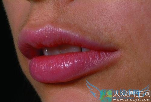 �촽������ô��