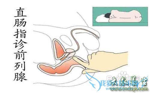 ǰ��������ô����� ǰ�����׵����ԭ��(3)