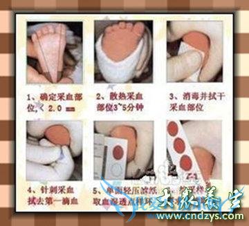 ���������Ѫ���ܼ��ʲô(2)