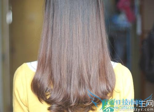 ͷ��������ʲôԭ��