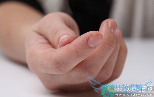 ������ָ�ؽ�����ô��