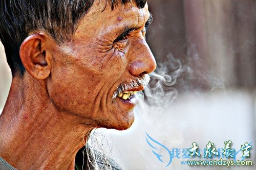 ������ϸ������Ĥ�׵�֢״