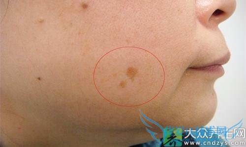 �ƺְߵĳ���֢״