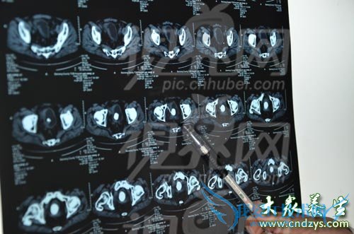 Ů�����λ��������(3)