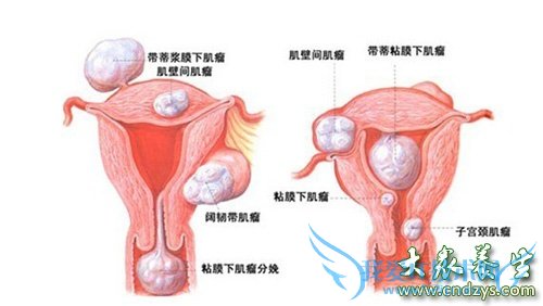 ���Ʋ��°����а�(3)