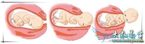 ʲô����̥ͷ����̥ͷ�Բ�����̥�����ײ�������֢(1)