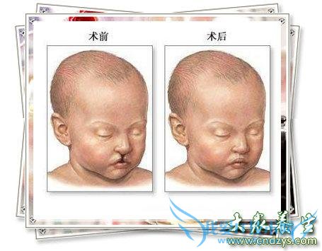 �ô����ٴ����֣��ô�Ԥ��(1)