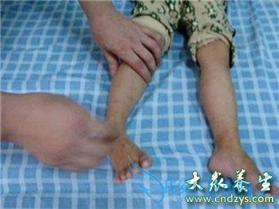  �������߾�����̱�𣬼������ߵı���(2)