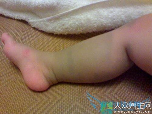 ����̥�ǰ��صļ����ź�(2)