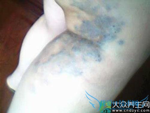 ����̥�ǰ��صļ����ź�(4)