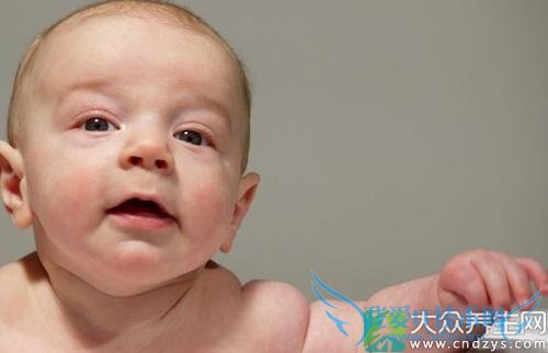 Ӥ��Ѫ����֢״