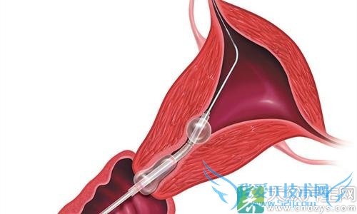 �ӹ�����������ԭ��