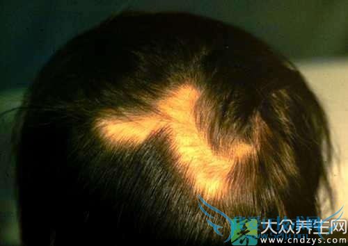 ��ͺ�Ĳ��� 