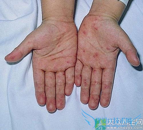 ����ڲ����ƺͻ���