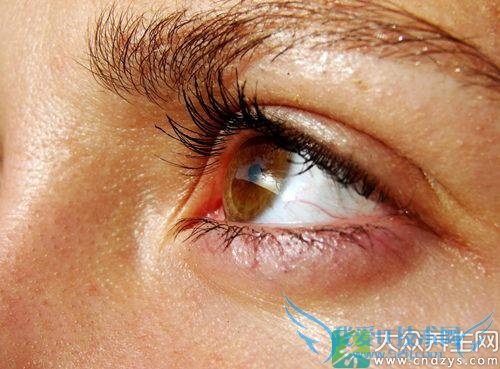 ��Ѫ������Ĥ��������Щ֢״