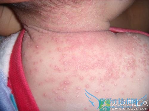 ��ͥ�ر���Ӥ��ʪ������Ʒ���