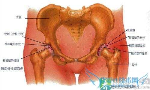 ��ʪ�Թؽ��׵����