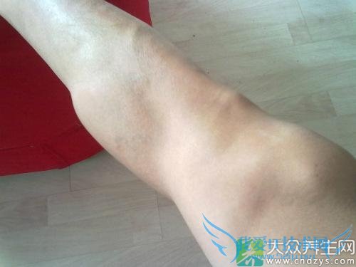 �Ȳ��������ŵ����Ʒ���