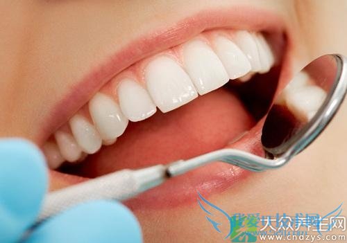 ȣ�ݵ�����