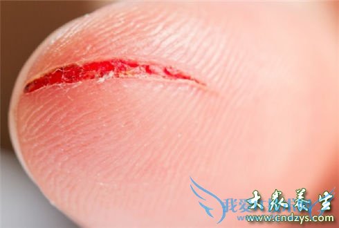 ��������������(4)