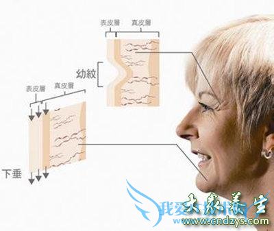 ʲô��˥�ϣ� ����˥�ϵ���������(4)