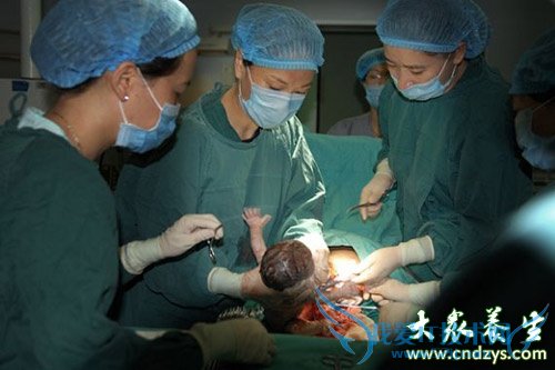 ����Ԥ����������������(5)