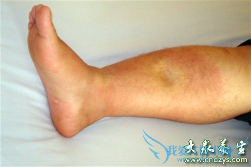 �������ಡ����յ���  (4)