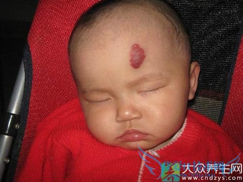 Ӥ��Ѫ�������Ʒ���