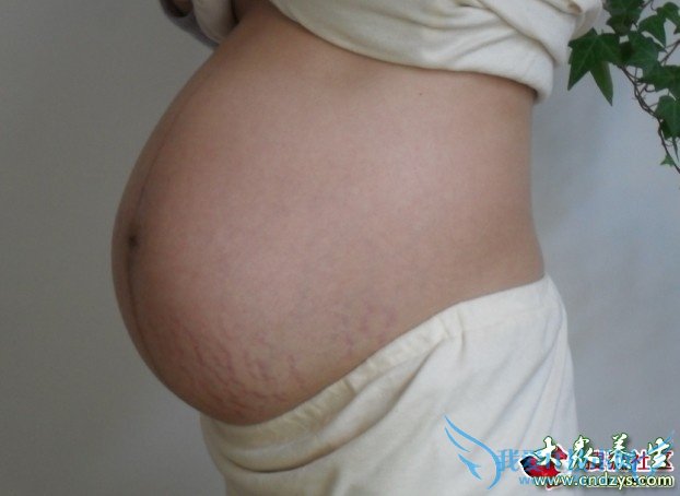 ����34��