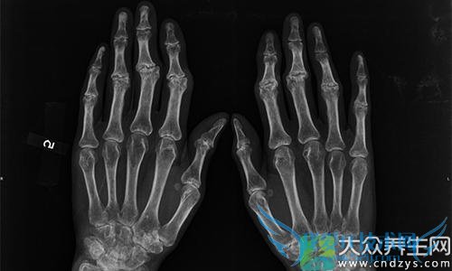 ��ʪ�Թؽ��׵Ļ���