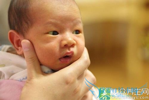 Ӥ��̥����֢״