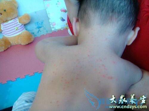 ��ͯʪ����ô��