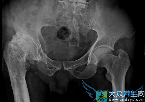 �Źؽڹ�����������Щ����