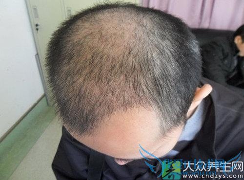 �����ѷ���ʳ��