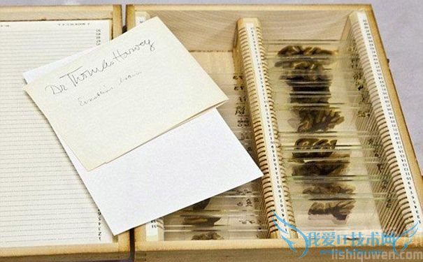 爱因斯坦的大脑切片 爱因斯坦的大脑切片