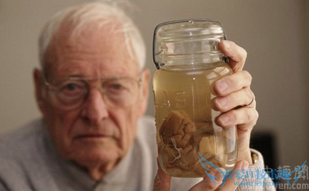 爱因斯坦的大脑 爱因斯坦的大脑