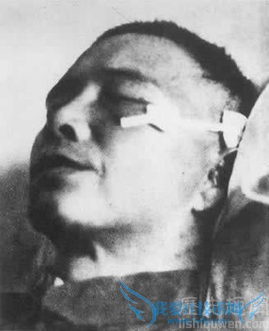 汪精卫被爱国志士孙凤鸣刺伤 汪精卫被爱国志士孙凤鸣刺伤