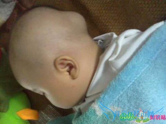 小孩摔跤磕破嘴唇长好后有个小包有点硬还能长 小孩摔跤磕破嘴唇长好后有个小包有点硬还能长