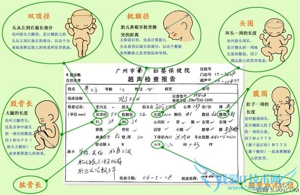 孕期B超单完全解读 52IJ母婴教育