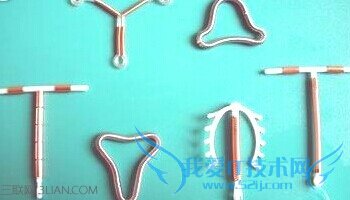 上环的最佳时间是什么时候 52IJ母婴教育