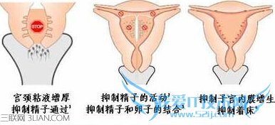 一般女性上环最佳时间是什么时候 52IJ母婴教育
