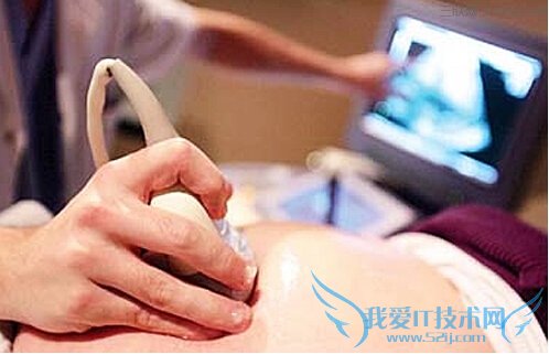 哪些准妈妈必须作产前筛查 52IJ母婴教育