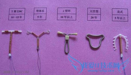 上环出现不良反应怎么办 52IJ母婴教育