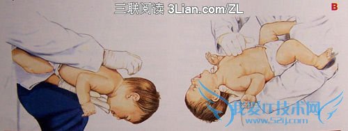 儿童误服异物送医前先催吐 52IJ母婴教育