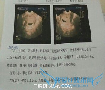 40ҴС         52IJĸӤ