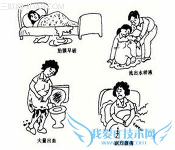 иô             52IJĸӤ