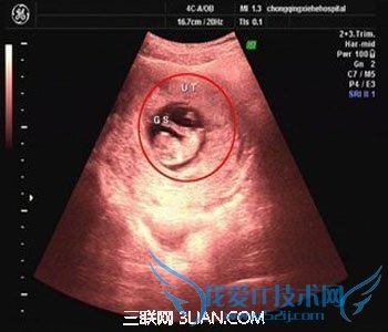 ����50�����Ҵ�С��׼ֵ          52IJĸӤ����